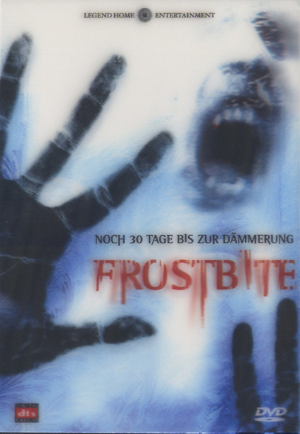 Frostbite
